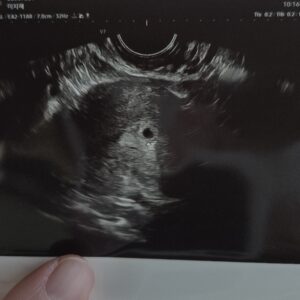 [임신일기-03] 아기집 집들이하러 병원에 방문하다. (4-5주차, 쓰리라인임테기, 동탄제일병원, 임신확인서) 임신일기3 2