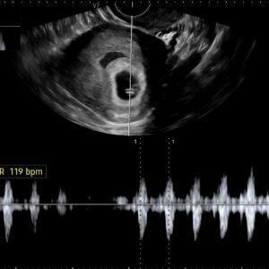[임신일기-04] 울컥했던 심장소리 듣기, 젤리곰 너무 귀여워 (6-8주차, 입덧 시작, 임신초기 해외여행, 갑상선 수치, 태명 짓기) 임신일기4 002